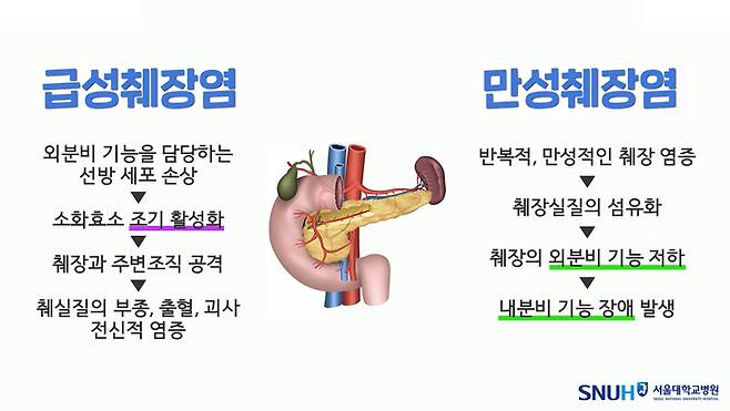 급성·만성 췌장염 비교(사진 : 서울대병원 제공) *재판매 및 DB 금지
