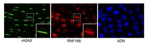 인간 세포의 DNA 손상 레이저 빔으로 DNA를 손상한 세포.
녹색은 기존의 복구 단백질 H2AX가 단절 부위에 결합한 모습.
적색은 새로 발견된 RNF166 단백질과 H2AX가 동시에 결합한 것.
[스페인 국립 암 연구 센터ㆍ미국 매사추세츠 제너럴 호스피털 제공. 재판매 및 DB 금지]