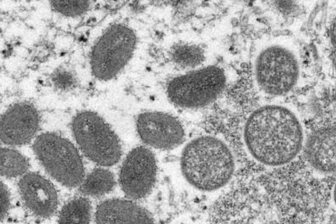 원숭이두창 바이러스의 입자 현미경 이미지. AP연합뉴