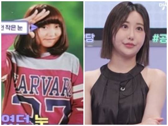 성형푸어 女 성형 전, 후 사진. 사진l채널A