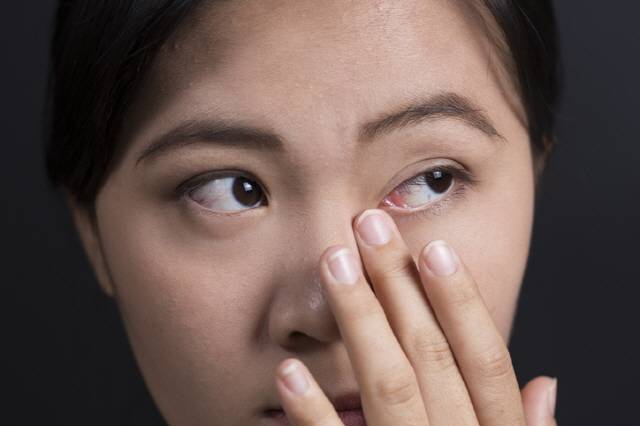 갑자기 눈곱이 많아졌다면 안질환의 신호일 수 있어 주의해야 한다./사진=게티이미지뱅크