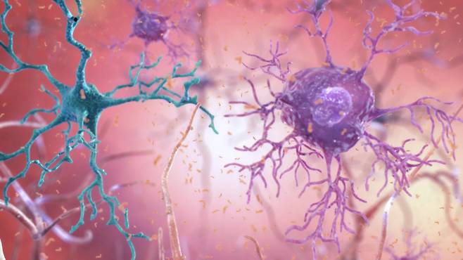 뇌 별세포 속 물질이 알츠하이머 유발 - 미국 국립보건원(NIH) 제공