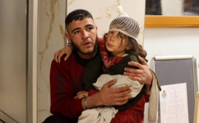 지난 6일 튀르키예 강진 여파로 다친 시리아 소녀. 사진=AFP연합뉴스