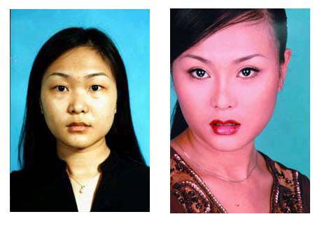 2003년 세계인의 이목을 집중시킨 ‘중국 최초의 인조미녀’ 하오루루의 사진. 전신 성형을 하면서 수술과 회복과정을 공개한 최초의 중국 여성이었다. <한겨레> 자료사진