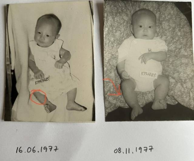 ▲입양 서류에 있는 사진 2장. 생후 5주때와 생후 7개월의 사진이다. 생후 5주 때 사진에는 다리의 큰 점 혹은 흉터가 있는데 생후 7개월 사진에서는 다리가 깨끗하다. 성인이 된 지금도 이런 자국이나 흉터가 없다. ⓒ필자 제공