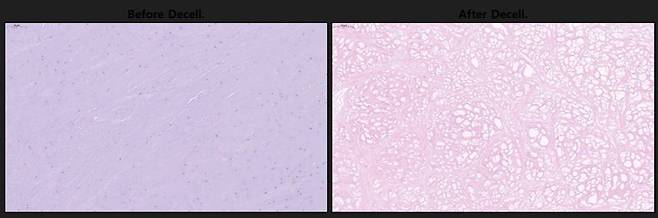 엠젠솔루션 탈세포화 전후 모습. 사진=엠젠솔루션