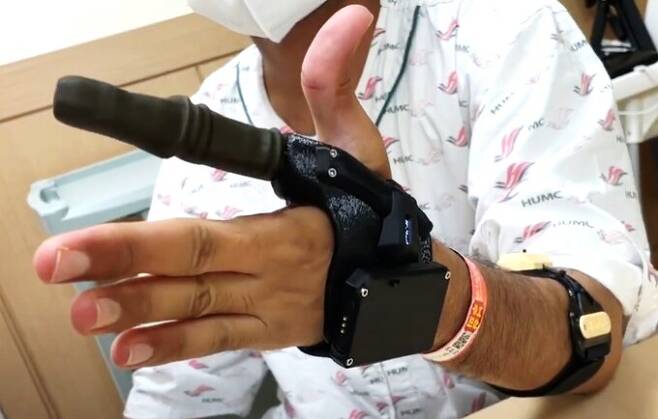 부분 손 절단 장애인이 마크 7D를 착용한 모습. 만드로 제공