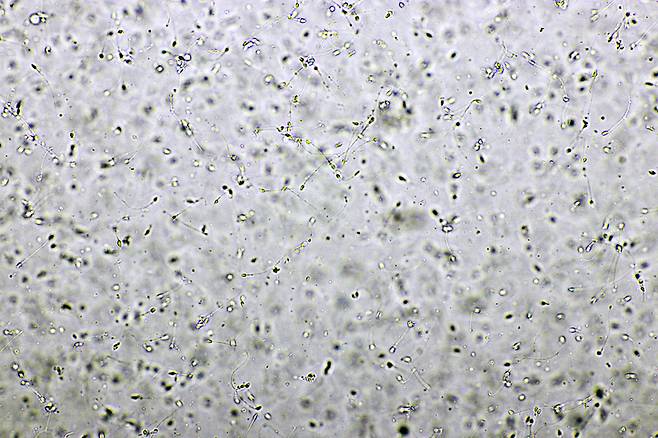 정액을 채취해 얻은 정자들.