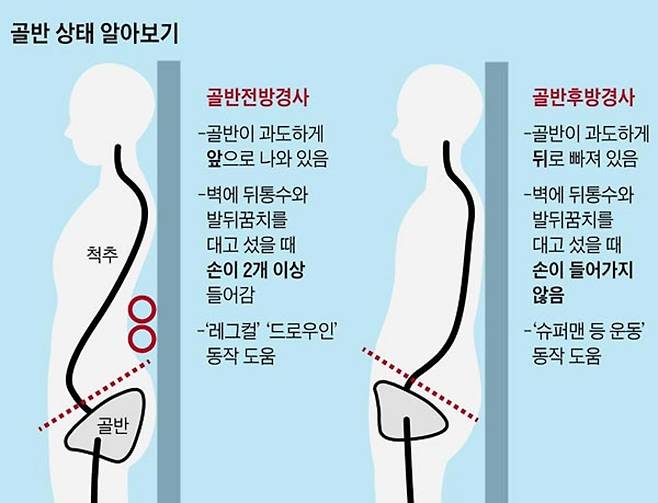 사진=헬스조선DB