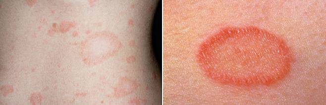 사진=Health Direct 제공