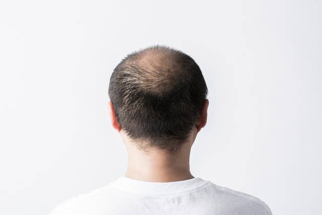 사진은 기사의 특정 내용과 관련 없음. 이미지투데이