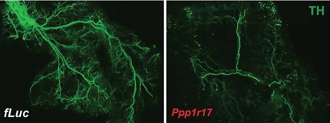 뇌 시상하부와 백색 지방 조직을 연결하는 신경망(왼쪽). 나이가 들면 신경세포 핵에서 Ppp1r17 단백질이 줄면서 이 신경망이 줄어든다(오른쪽)./미 워싱턴대