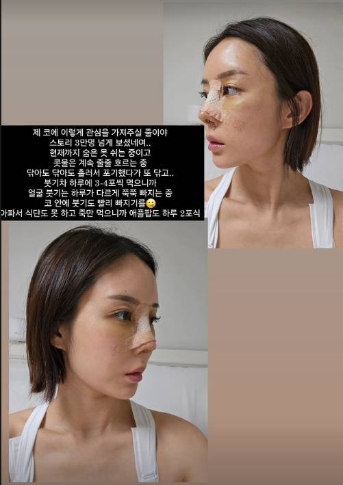 이소라 소셜미디어