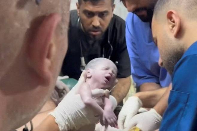 팔레스타인 가자지구 라파에서 공습으로 치명상을 입은 엄마의 배 속에 있던 한 아기가 응급 제왕절개 수술을 통해 극적으로 생명을 건진 모습. (사진=로이터 TV 영상 갈무리)