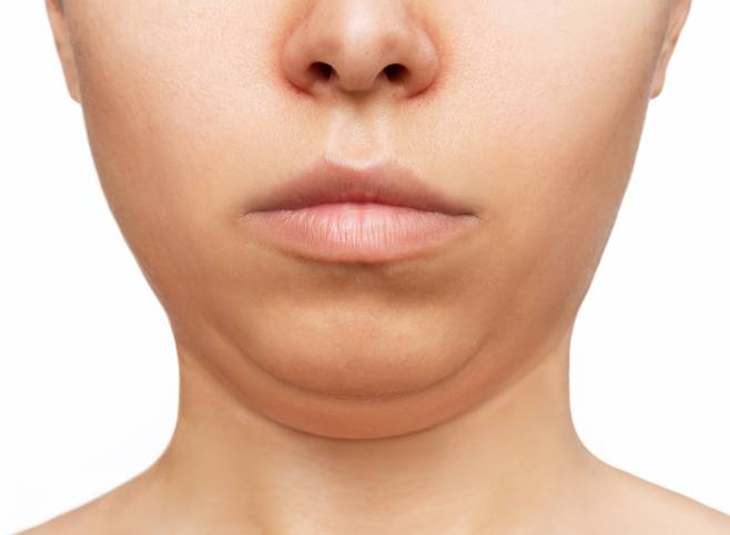 이중턱의 원인은 단순히 살이 찐 것 외에도 노화, 거북목, 침샘비대증 등 다양하다./사진=클립아트코리아
