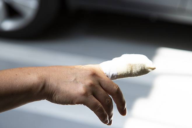 지난 3일 국제학술지 ‘Clincial Case Reports’에는 신체통합정체성장애 때문에 손가락 두 개를 절단한 20세 남성의 사례가 보고됐다./사진=클립아트코리아