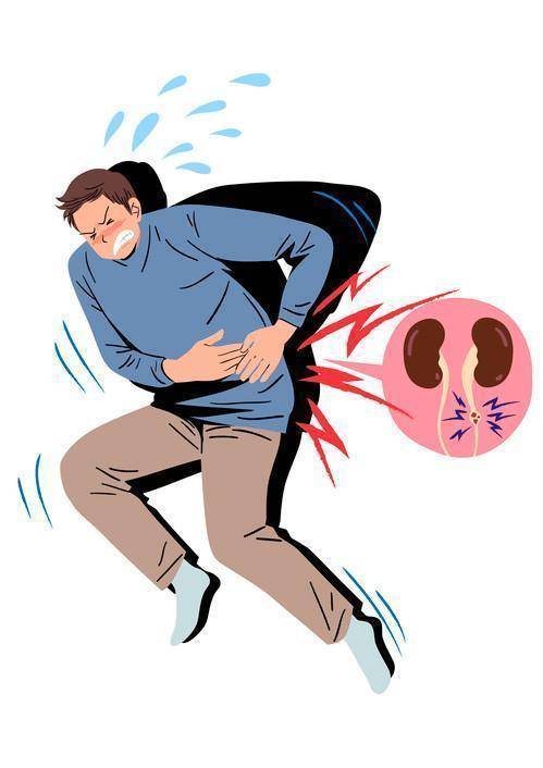 요로결석은 여름철에 가장 많이 발생한다. 이는 땀을 많이 흘리면서 수분이 소실되고, 햇빛에 많이 노출돼 비타민 D 생성이 늘어나기 때문이다. 게티이미지뱅크