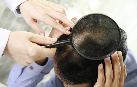 효과적인 탈모치료를 위해서는 치료 약물의 차이점을 알아둬야 한다|출처: 클립아트코리아