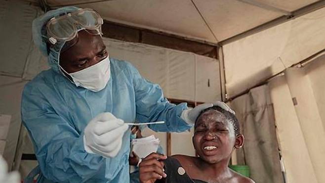콩고민주공화국의 한 병원 엠폭스 치료센터에서 검사를 받는 환자. 연합뉴스