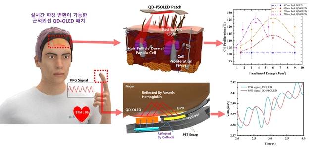 탈모 치료용 QD-OLED 패치. 한국연구재단