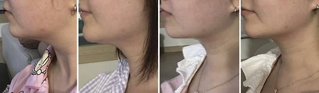 하이포커스샷 실제 이용자의 이용 후기/사진제공=에이피알