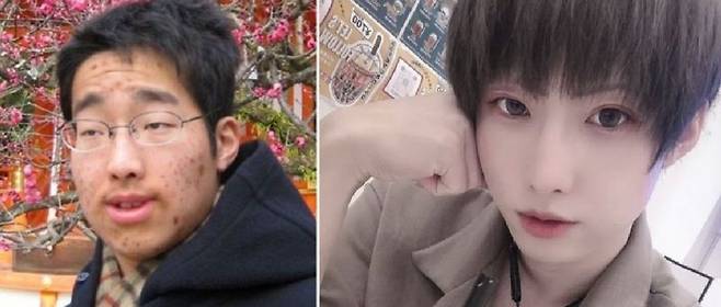 일본의 한 인플루언서가 외모 때문에 괴롭힘을 당한 뒤, 다이어트 성공 후 다른 삶을 살고 있다는 사연이 다시금 화제다./사진=주간문춘, 히야니키 SNS