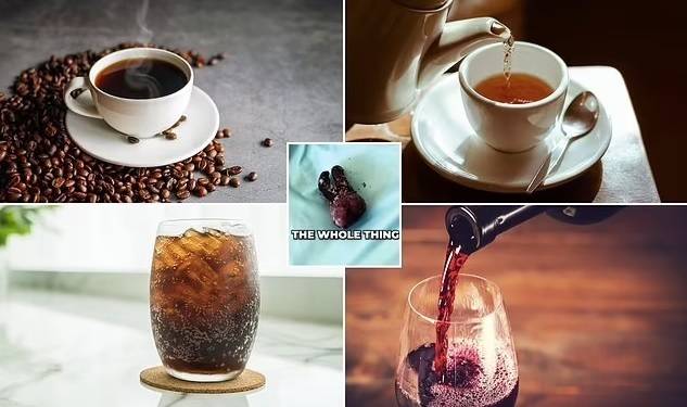 음료가 치아 변색에 미치는 영향에 대한 실험 결과. 영국 ‘데일리메일’ 캡처