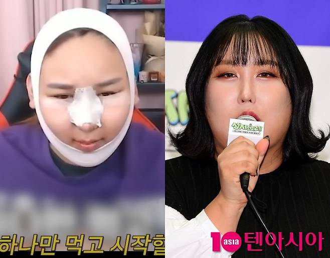 사진=유튜브 'A급 장영란' 영상 캡처, 텐아시아 DB