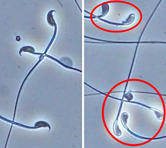 정상적인 쥐의 정자(왼쪽)와 유전자가 결손되어 이상이 일어난 쥐의 정자. 오사카대 제공