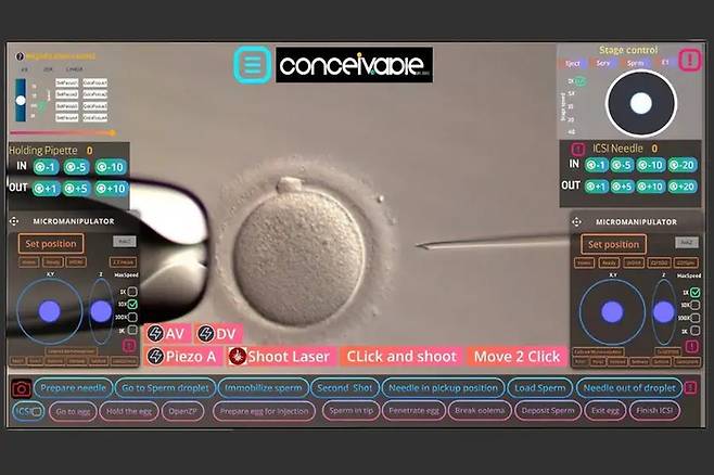 원격으로 로봇을 조종해 진행한 체외수정(IVF; 시험관 아기 시술). 사진=컨시버블 라이프 사이언스