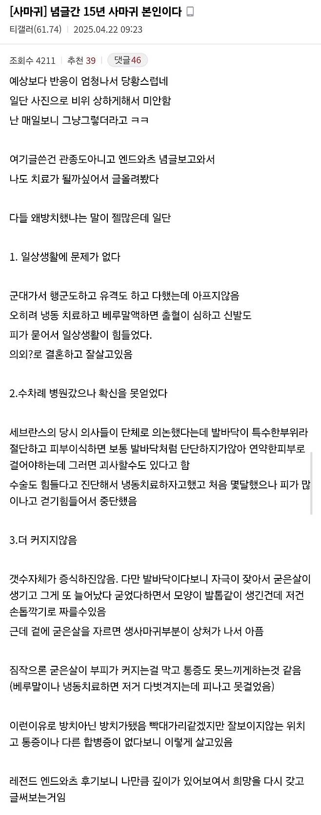 Screenshot_20250422_171849_Samsung Internet.jpg 발바닥 버섯 사마귀 당사자가 사마귀를 방치한 이유
