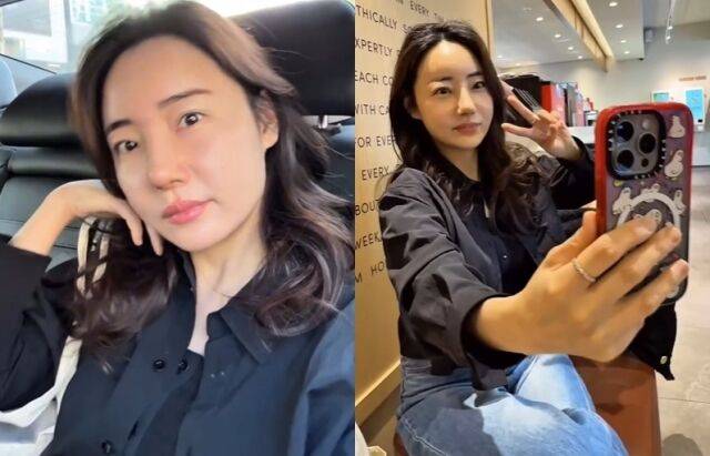 부목을 제거한 박혜민 / 박혜민 소셜미디어