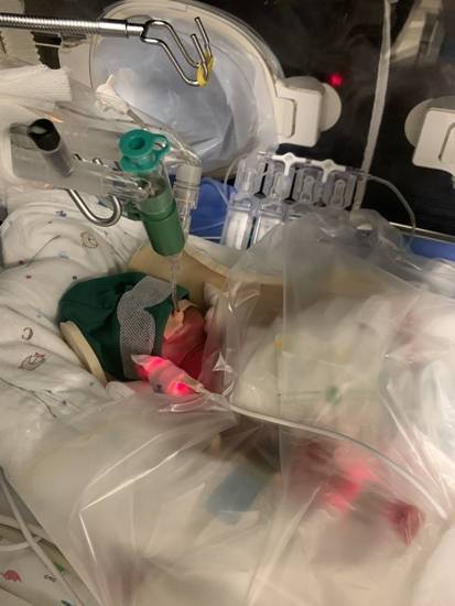 유준이의 신생아중환자실 입원 첫 날 모습. 서울성모병원 제공