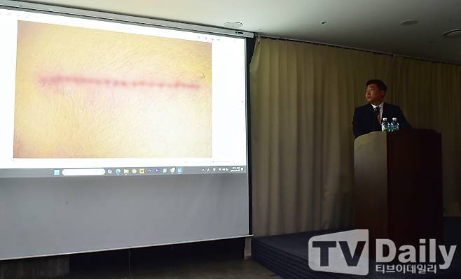 사진=티브이데일리 DB