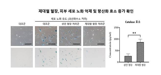 제대혈 혈장, 피부 세포 노화 억제 및 항산화 효소 증가 확인. (메디포스트 제공)