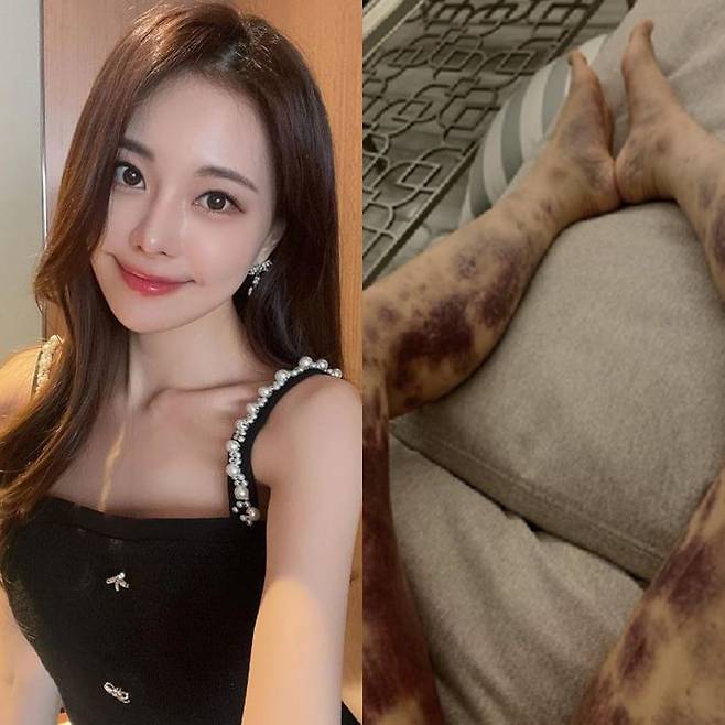 사진=아옳이 SNS.