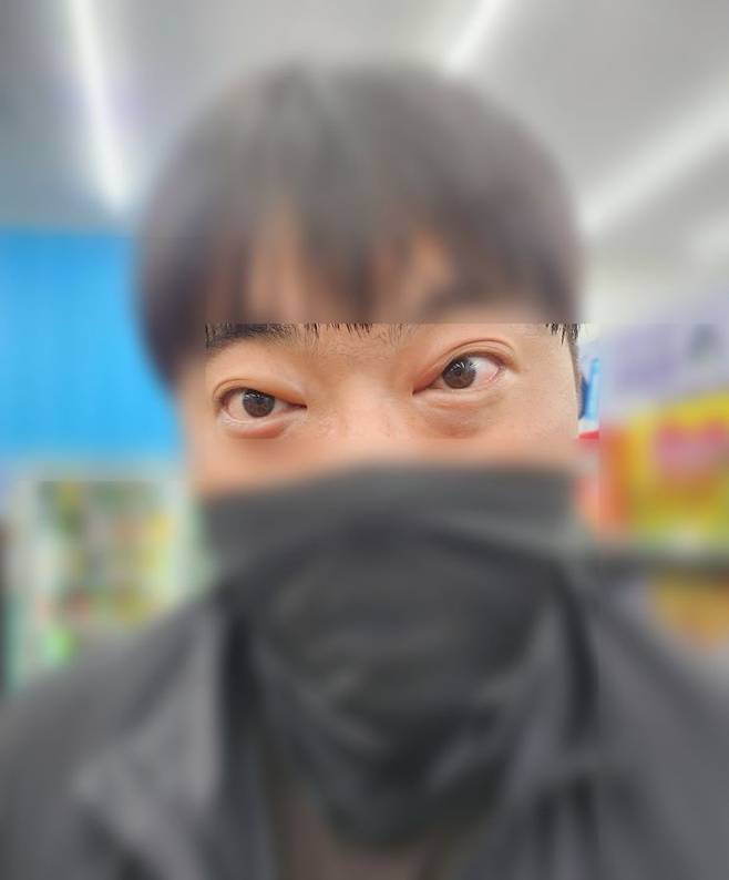 20일 오후 광주 광산구 소촌동 한 주민이 금호타이어 광주공장 화재에서 나온 연기로 인해 눈에 통증을 호소하고 있다. 독자 제공