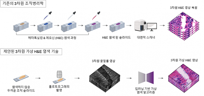 기존 3차원 조직 병리학 절차와 공동연구팀이 제안한 3차원 가상 H&E 염색 기술의 비교 자료. 기존 방식은 수십 장의 조직 슬라이드 제작 및 염색이 필요하다. 반면 공동연구팀이 개발한 기술은 최대 10배까지 슬라이드 수를 줄이고, 염색 과정 없이 빠르게 H&E 영상을 생성할 수 있다. KAIST 제공