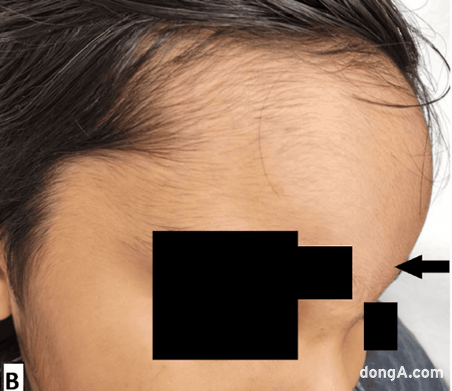 사진=Cureus 5월 호 캡처.