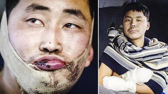 볼로디미르 젤렌스키 우크라이나 대통령은 지난 1월 우크라이나군이 러시아 서부 쿠르스크 지역에서 북한 군인 2명을 생포했다고 밝혔다. 젤렌스키 엑스 캡처