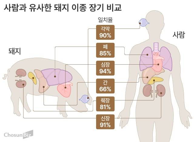 사람과 유사한 돼지 이종 장기 비교./그래픽=손민균