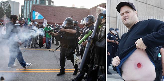 LA의 혼돈과 상처 9일(현지시간) 미국 캘리포니아주 로스앤젤레스(LA)에서 이민자 추방에 반대하는 시위 참가자를 향해 경찰이 비살상무기를 사용하고 있다(왼쪽 사진). 지난 8일 한 시위 참가자가 경찰 진압으로 생긴 상처를 보여주고 있다. AFP신화연합뉴스