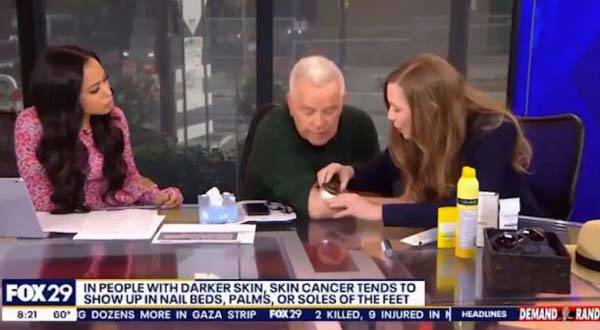 생방송 도중 피부암의 일종인 기저세포암 진단을 받은 마이크 제릭./사진=폭스뉴스