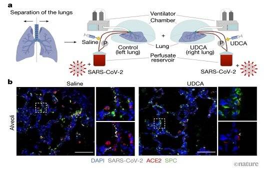 UDCA는 ACE2 수용체의 문을 닫아 감염을 차단한다ㅣ출처: Nature