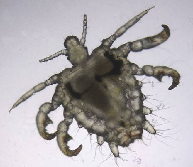 사면발이 실물 사진/사진=Dermoscopy of pediculosis pubis