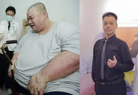 대만 남성 우모(45)씨는 몸무게가 280㎏까지 불어나며 6년 동안 집 밖으로 나가지 못했다.(왼쪽) 의료진의 도움으로 현재는 몸무게가 80㎏까지 줄었다. 자료 : 대만 타이베이 츠지병원