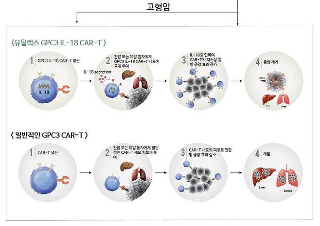 유틸렉스의 고형암 타깃 CAR-T 치료제 EU307의 특징. 만성 염증 환경에서 간섬유화를 일으키는 IL-18가 면역이 억제된 종양환경에서 CAR-T의 지속성 및 항 종양 효과를 높일 것으로 보고 있다. (자료=유틸렉스)