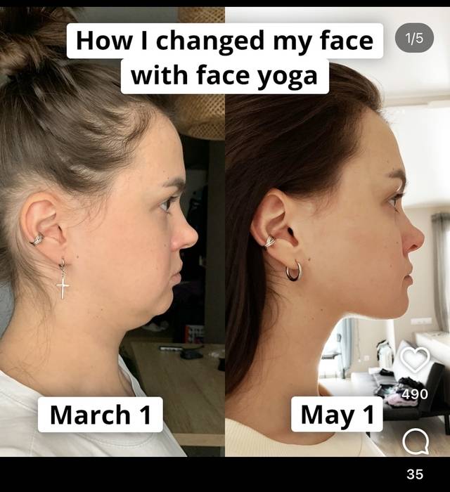 온라인에서 얼굴 요가로 효과를 봤다고 주장하는 글을 쉽게 찾아볼 수 있다. 인스타그램 캡처.