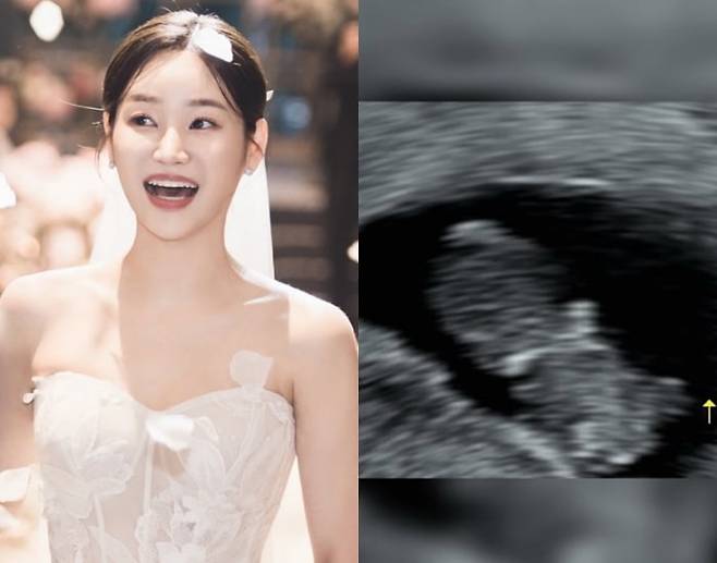 그룸 AOA 유나 /사진=인스타그램 캡처