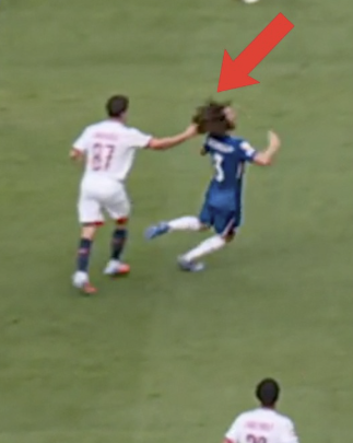 쿠쿠렐라 머리를 잡은 주앙 네베스. ESPN